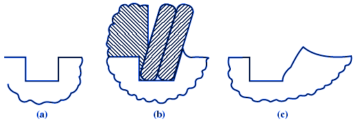 Retaining ring yielding and groove under loading.